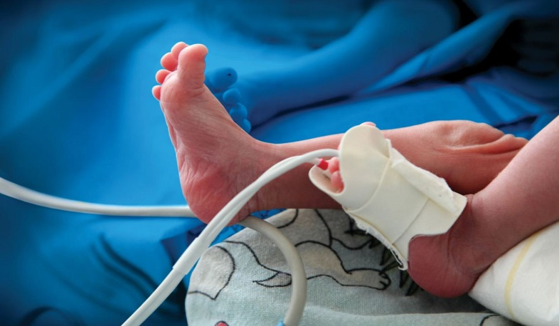 Հայաստանը մանկական մահացության կանխարգելման Կայուն զարգացման նպատակներին հասած սակավաթիվ երկրներից է