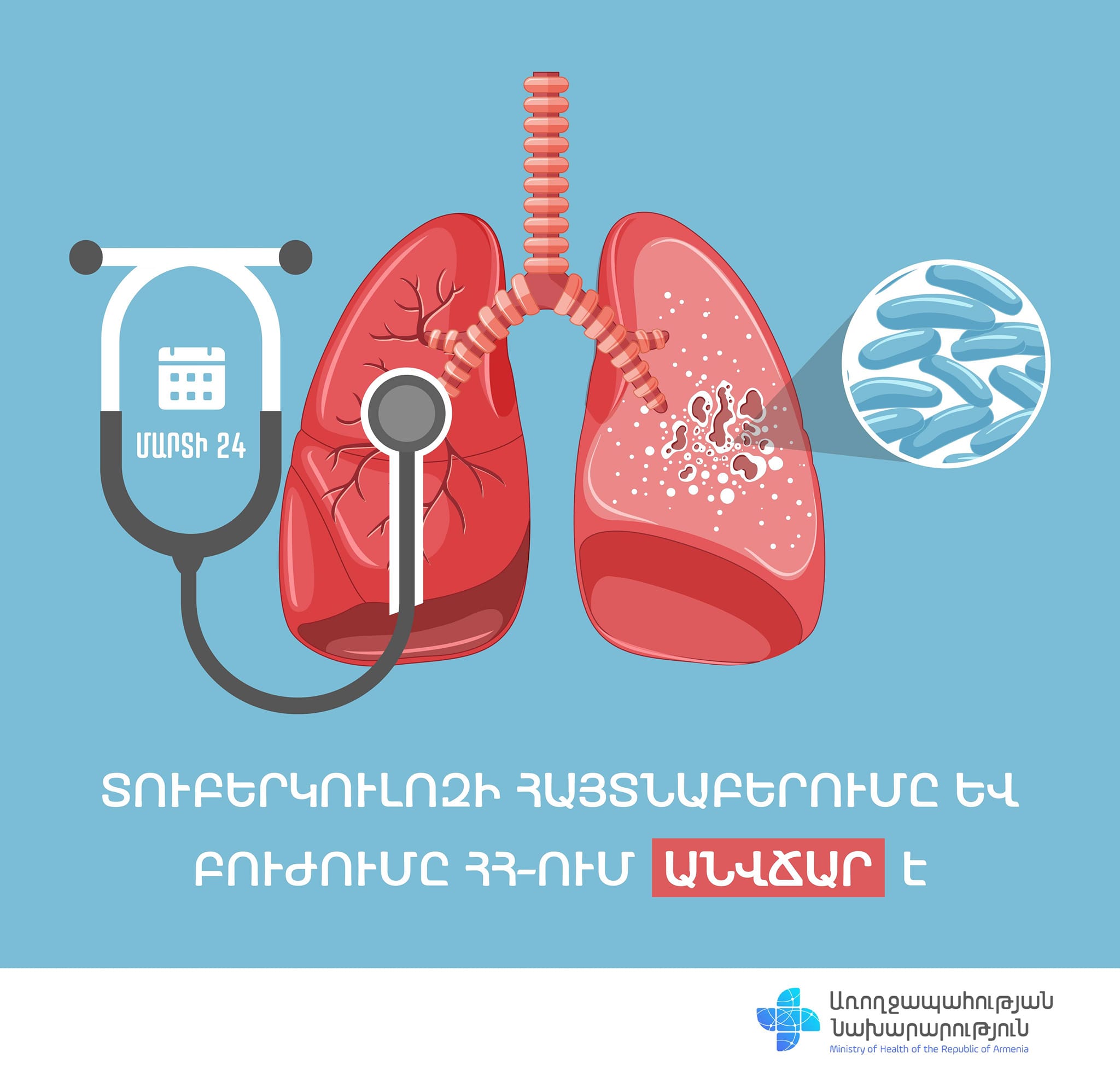 Տուբերկուլոզի բուժումը և հայտնաբերումը Հայաստանում անվճար է