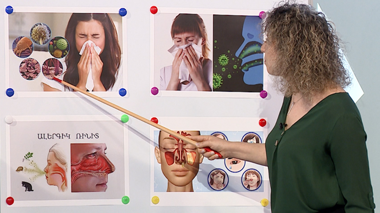 First Aid: Allergic Rhinitis, Dietologist, Allergy