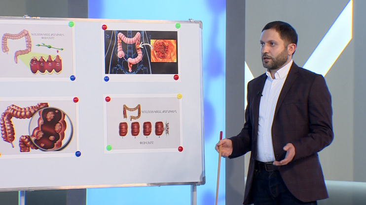 Первая помощь. Колоректальный рак