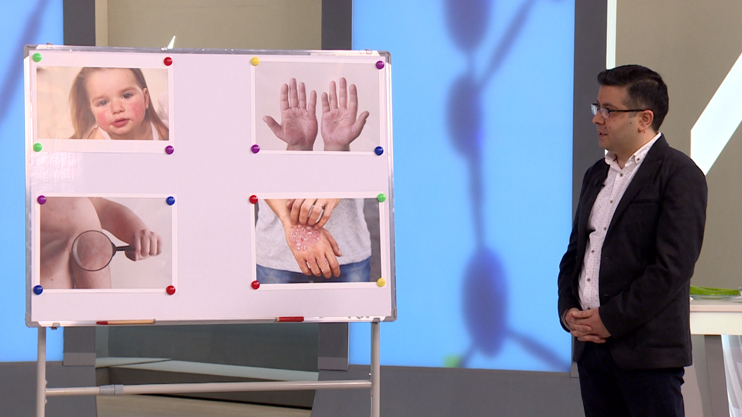 First Aid: Childhood Cancer, Hematological Diseases, Eczema