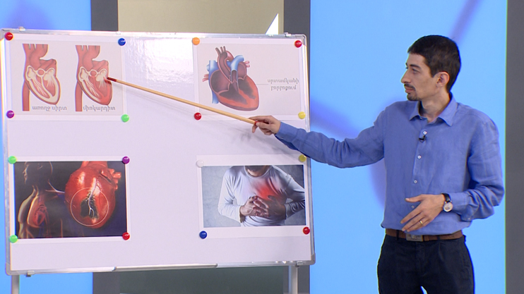 Первая помощь. Миокардит, воспаление сердечной мышцы