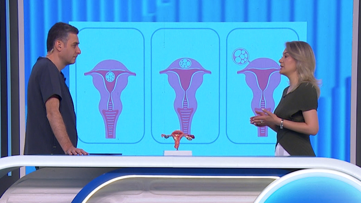 Be Healthy: Uterine Fibroid