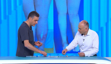 Be Healthy! Varicose Veins