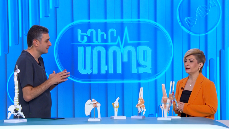 Եղիր առողջ. արթրիտ