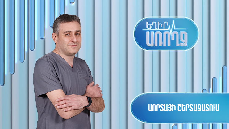 Եղիր առողջ. Աորտայի շերտազատում