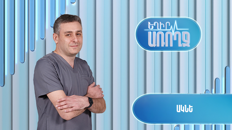 Եղիր առողջ. ակնե
